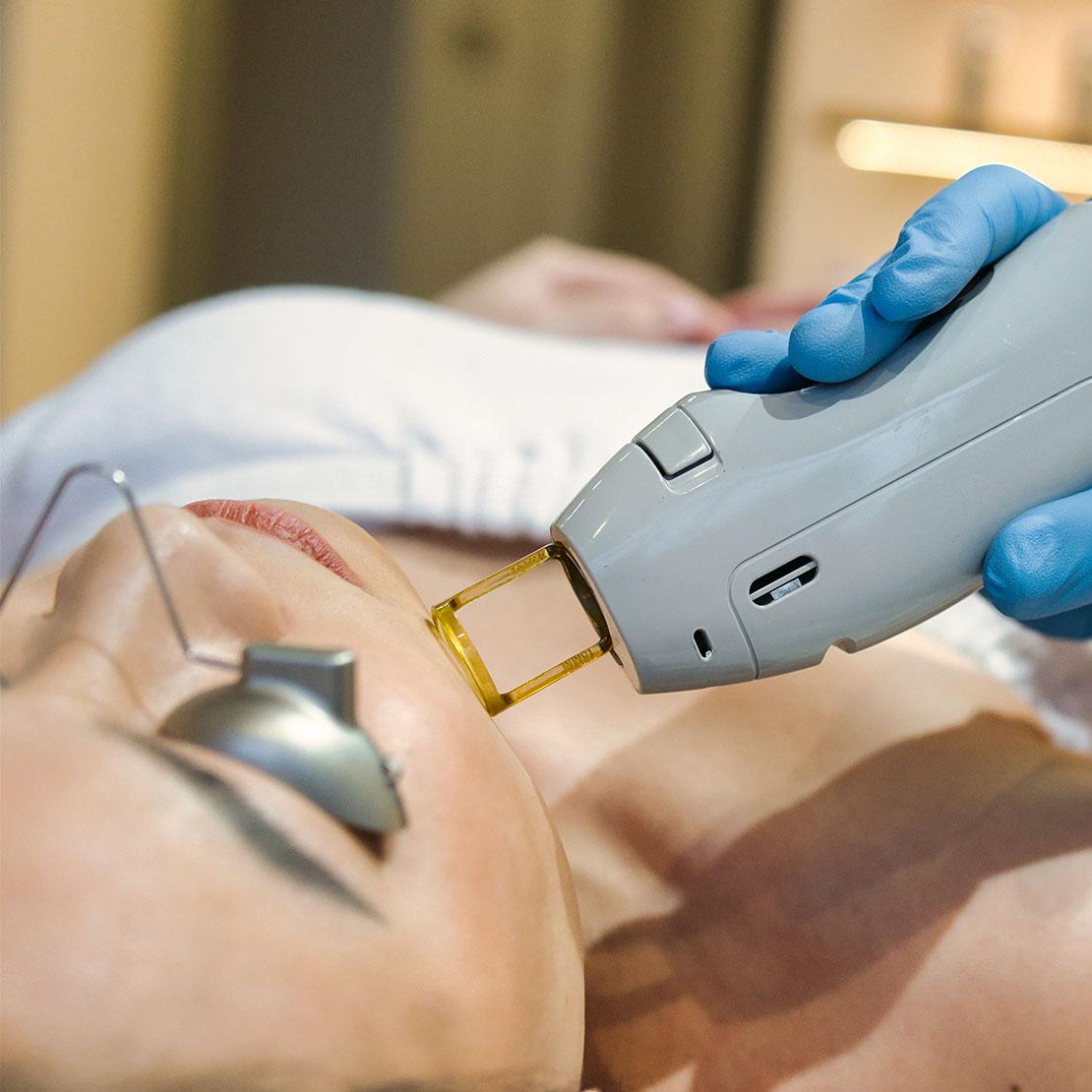 Customizable Treatments: Tailoring Your Hair Removal Experience ⁤for Optimal Results